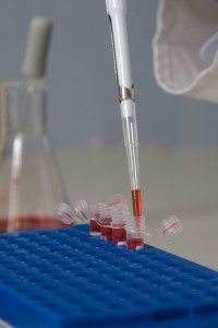 HIV Testing Lab Testing