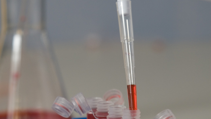 Advances in HIV Testing